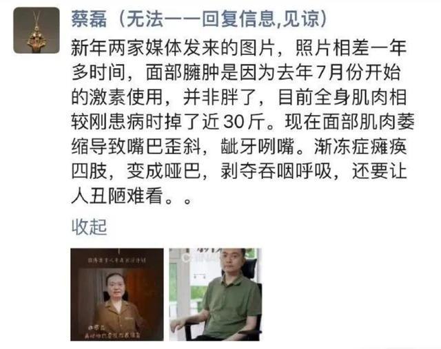 舌头已萎缩用眼控仪打字与儿子亲密互动爱游戏app入口蔡磊现状令人泪目嘴唇(图5)